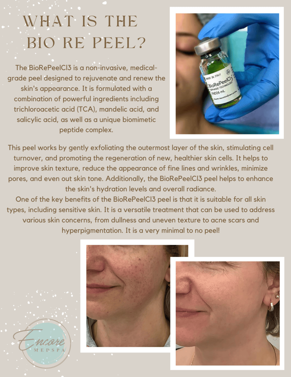 what is the bio re peel? The BioRePeelCl3 is a non-invasive, medical-grade peel designed to rejuvenate and renew the skin's appearance. It is formulated with a combination of powerful ingredients including trichloroacetic acid (TCA), mandelic acid, and salicylic acid, as well as a unique biomimetic peptide complex. This peel works by gently exfoliating the outermost layer of the skin, stimulating cell turnover, and promoting the regeneration of new, healthier skin cells. It helps to improve skin texture, reduce the appearance of fine lines and wrinkles, minimize pores, and even out skin tone. Additionally, the BioRePeelCl3 peel helps to enhance the skin's hydration levels and overall radiance. One of the key benefits of the BioRePeelCl3 peel is that it is suitable for all skin types, including sensitive skin. It is a versatile treatment that can be used to address various skin concerns, from dullness and uneven texture to acne scars and hyperpigmentation. It is a very minimal to no peel! images of the bio re peel bottle and before and after images showing a woman's face with less dark spots in the after image.