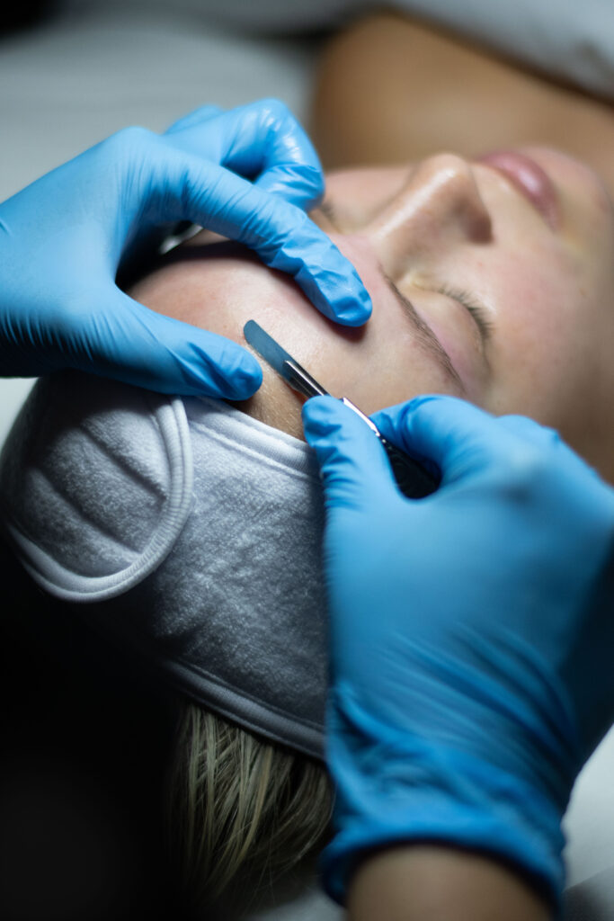 dermaplaning during brightening facial