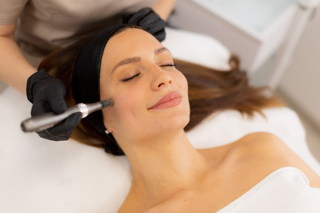 Rejuran® microneedling treatment