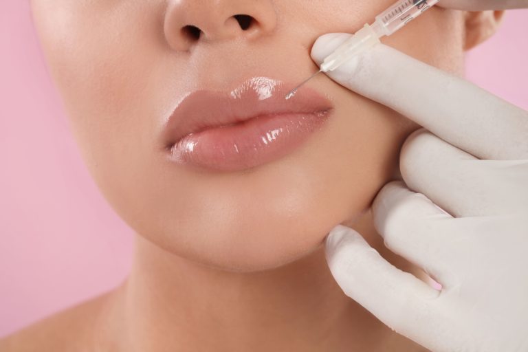Lip Fillers Injections Treatment in Pleasanton, CA | Encore MedSpa